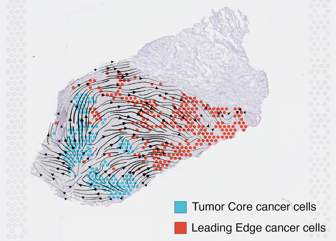 Spatial transcriptomics